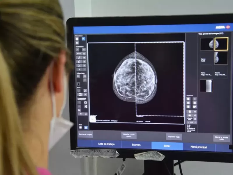 QAC y el Hospital Iriarte facilitan el acceso a mamograf&iacute;as