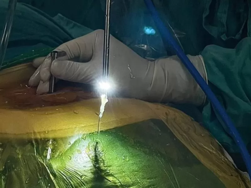 En Córdoba se realizó las primeras cirugías endoscópicas de columna